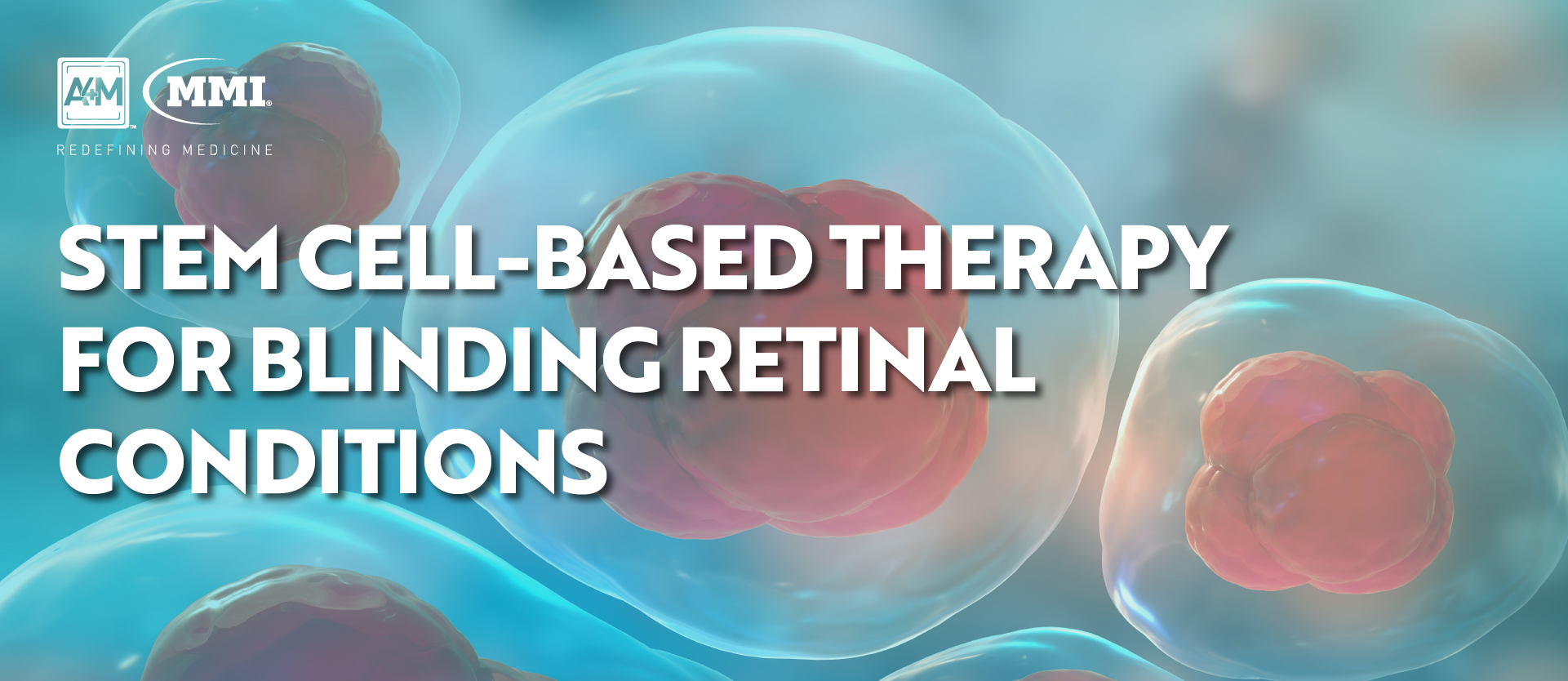 Stem CellBased Therapy for Blinding Retinal Conditions