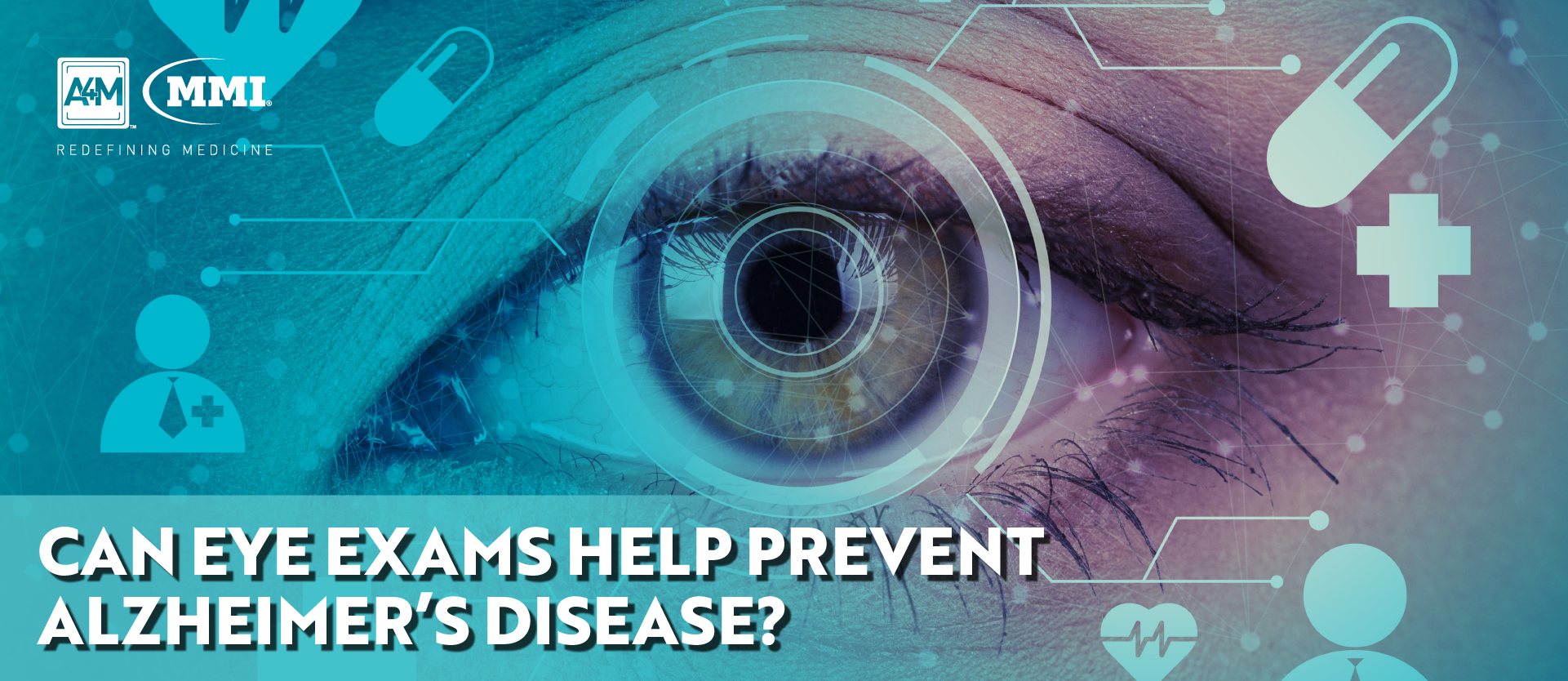 can-eye-exams-help-prevent-alzheimer-s-disease-a4m-blog