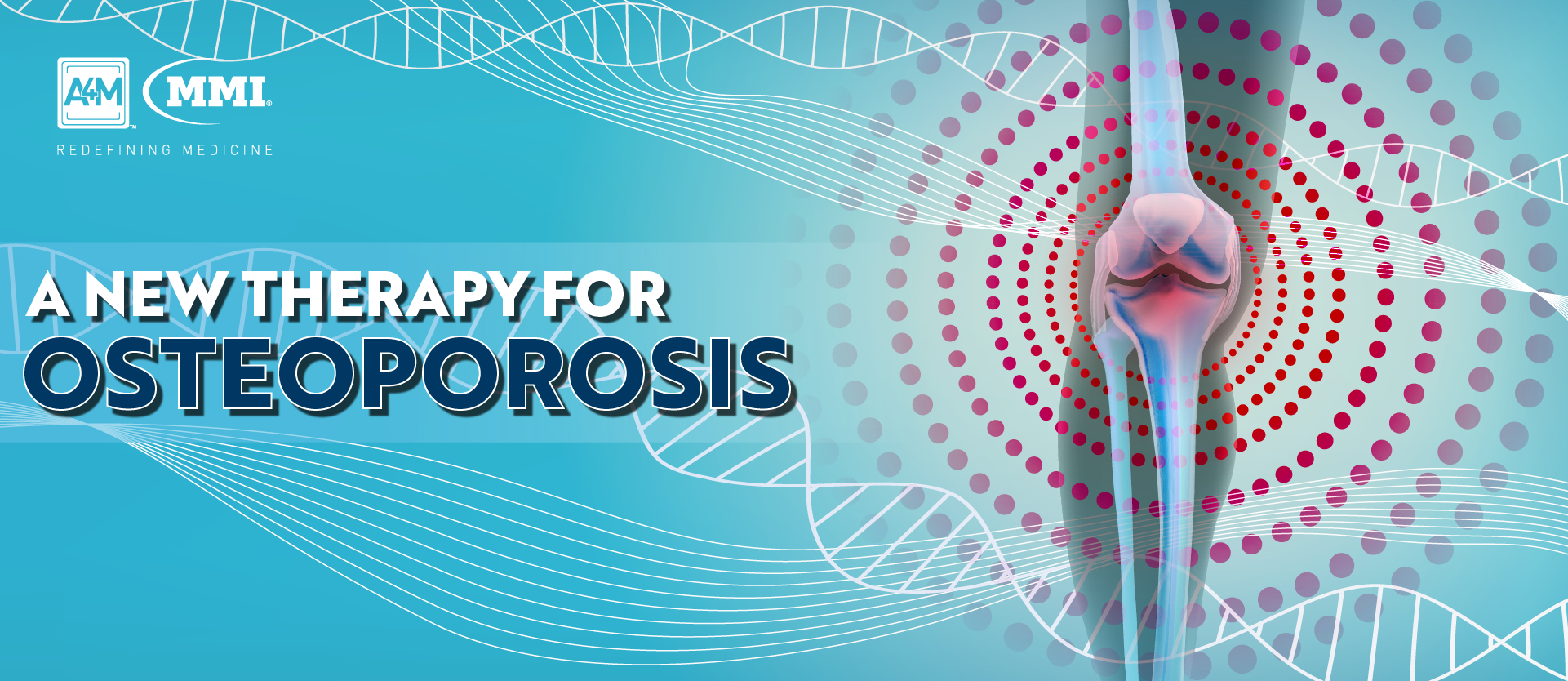 A New Therapy for Osteoporosis • A4M Blog