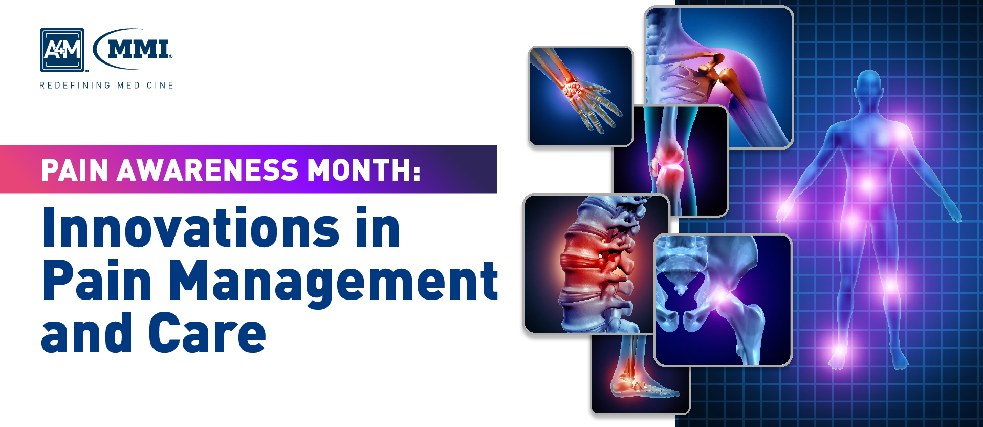 Pain Awareness Month Innovations in Pain Management and Care • A4M Blog